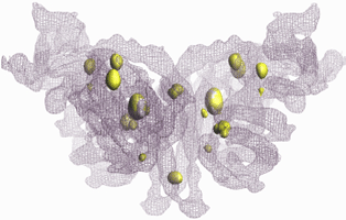 Fig. 2 Structure of complex of histidine kinase and response regulator.