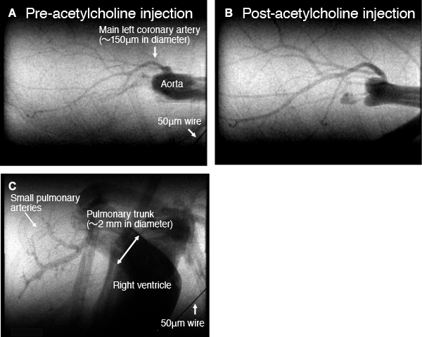 Fig. 1 In vivo coronary and cardiopulmonary microangiograms of the intact chest in an anesthetized mouse (heart rate: up to 500 beats/min): the coronary arteries (A, B) and the right ventricle and pulmonary arteries (C)