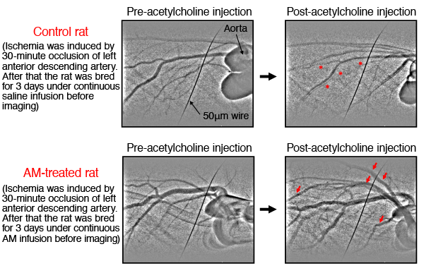 Fig. 2 Adrenomedullin (AM) improves the endothelial function of post-ischemic-reperfusion small coronary arteries of rats.