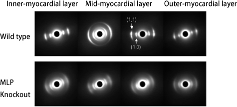 Figure 3. X-ray diffraction patterns of the heart of normal mice and that of a mouse model of myocardial disease