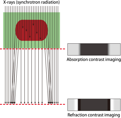 Figure 1. Refraction contrast imaging and absorption contrast imaging