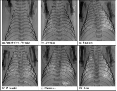 Figure 2. Chest images of newborn rabbits