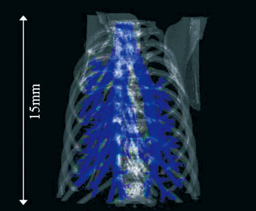 Fig. 1 X-ray CT image of mouse chest.