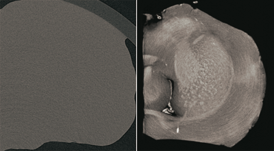 Fig. 4 X-ray CT image of rat cerebrum (provided by Dr. Hiroshi Onodera at Nishitaga National Hospital, JST-CREST).