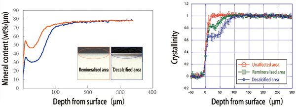 Fig. 4 Remineralization by POs-Ca (left) and effect of recrystallization (right).