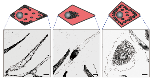 Fig. 4 Mechanism of melanosome transport in melanocyte