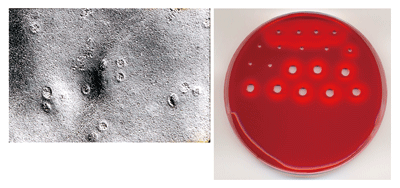 Photograph 1. Pores formed by TDH on cell membrane (left) and view of hemolysis (right)