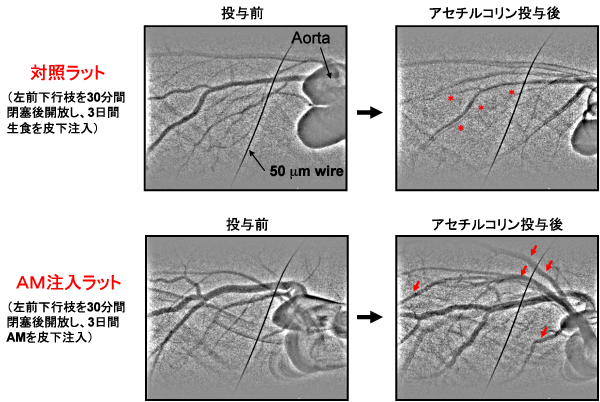 図2　アドレノメデュリン（ＡＭ）はラット心臓虚血再灌流後の冠細動脈内皮機能を改善する