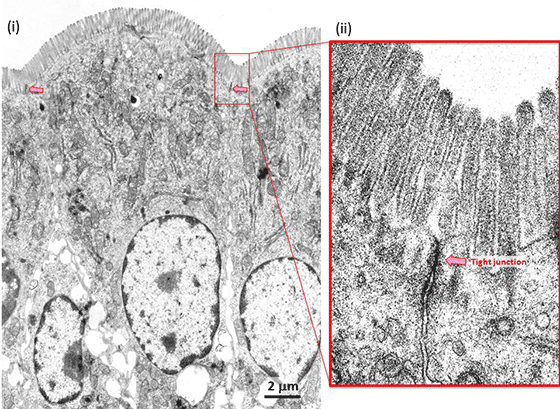 図３．小腸上皮細胞の電子顕微鏡像（i）と、赤い枠で示した部分の拡大像（ii）