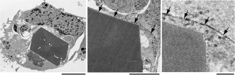 図6　細胞質内にXpa結晶を抱えるHEK293細胞の透過型電子顕微鏡画像