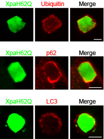 図7　 Xpa改変体の結晶がユビキチン、p62、LC3で標識されている様子