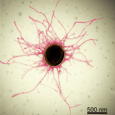 図１：ポルフィロモナス・ジンジバリス（ジンバリス菌）の電子顕微鏡画像