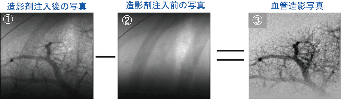 図1.ラットの肺動脈における血管造影写真の仕組み