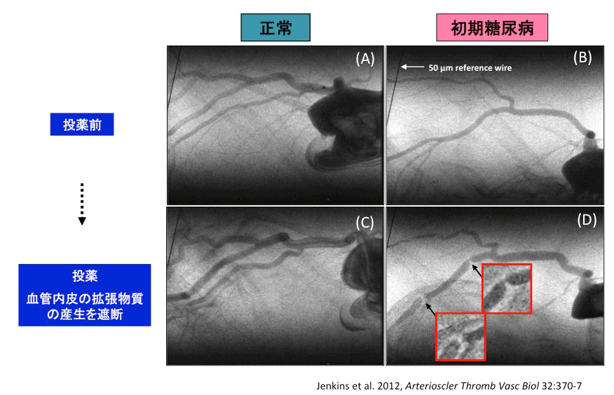 図3. 高分解能微小血管造影法で得られた成果。