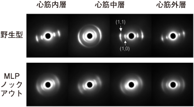 図3.健常な心臓と心筋症の心臓のX線回折像