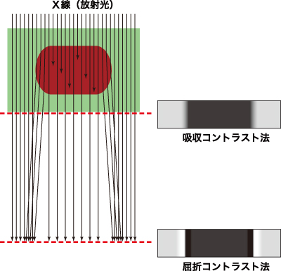 図1.屈折コントラストイメージング法と吸収コントラストイメージング法