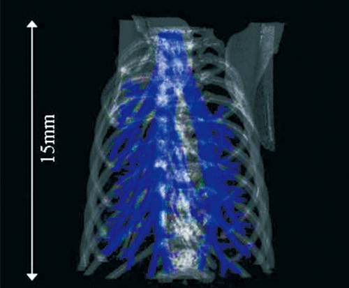 図1. マウス胸部のX線CT画像。