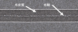 図1. 毛髪一本のＸ線屈折コントラスト画像
