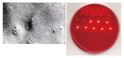 写真1．TDHが細胞膜に開ける孔（左）と溶血の様子（右）