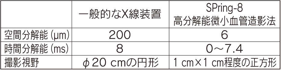 表１ 一般的な病院のX線装置とSPring-8高分解能微小血管造影法の違い